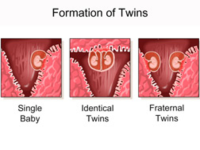Formation_of_Twins